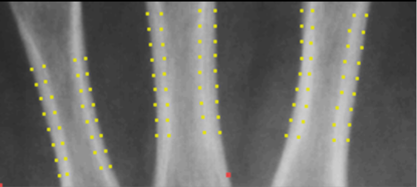 How well does Bone Health Index correlate with DXA?