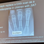 Hand radiographs as a potential replacement for DXA in osteopenia screening